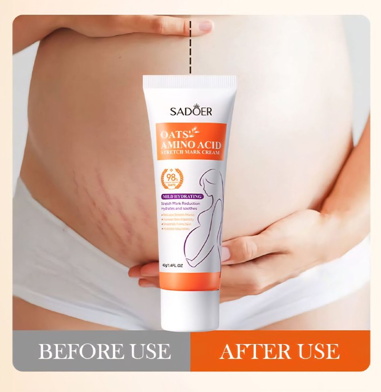 CREMA CORPORAL PARA ESTRIAS CON AMINOACIDOS DE AVENA SADOER 40G