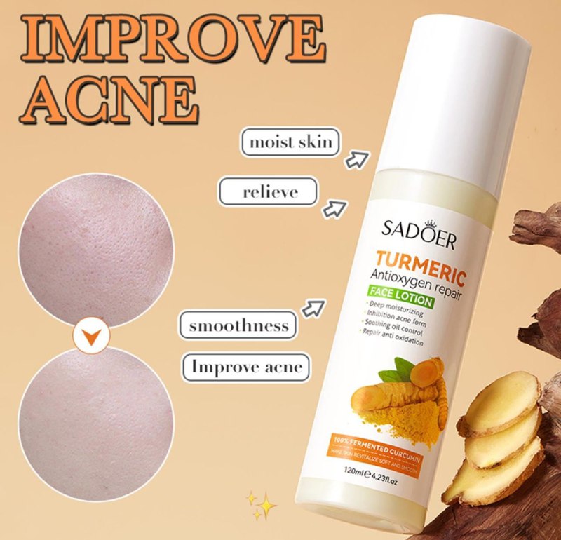 CREMA FACIAL ANTIACNE HIDRATANTE CON CURCUMA SADOER 120ML