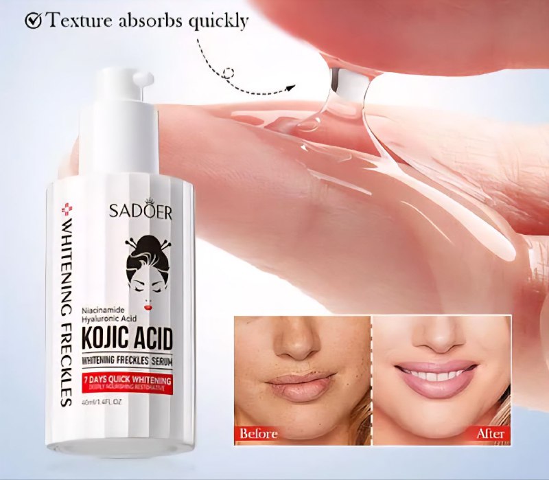 SUERO FACIAL BLANQUEADOR DE PECAS CON NIACINAMIDA Y ACIDO HIALURONICO, HIDRATA, BLANQUE Y ELIMINA LAS IMPERFECCIONES SADOER 40ML
