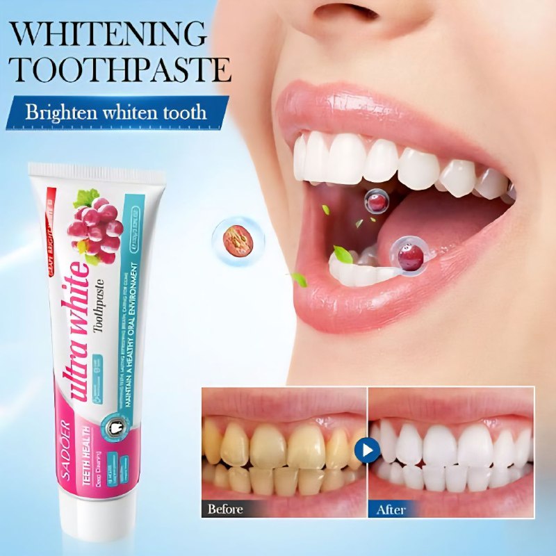 PASTA DE DIENTES, DE UVA BLANCA, DEJA BRILLANTE LOS DIENTES, ELIMINA MANCHAS DIFICILES Y EL SARRO BLANDO, DIENTES AMARILLOS, BLANQUEA Y ABRILLANTE LOS DIENTES CUIDA LAS ENCIAS Y REFRESCA EL ALIMENTO SADOER 100G