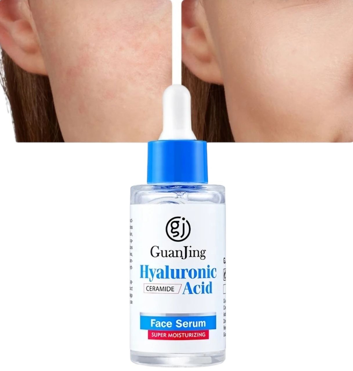SUERO FACIAL DE ACIDO HIALURONICO HIDRATANTE PROMUEVE LA GENERACION DE COLAGENO DE LA PIEL, BLANQUEA, HIDRATA, ACLARA MANCHAS, ELIMINA ACNE, SUAVIZA LINEAS GUAJING HYALURONIC ACID 40ML