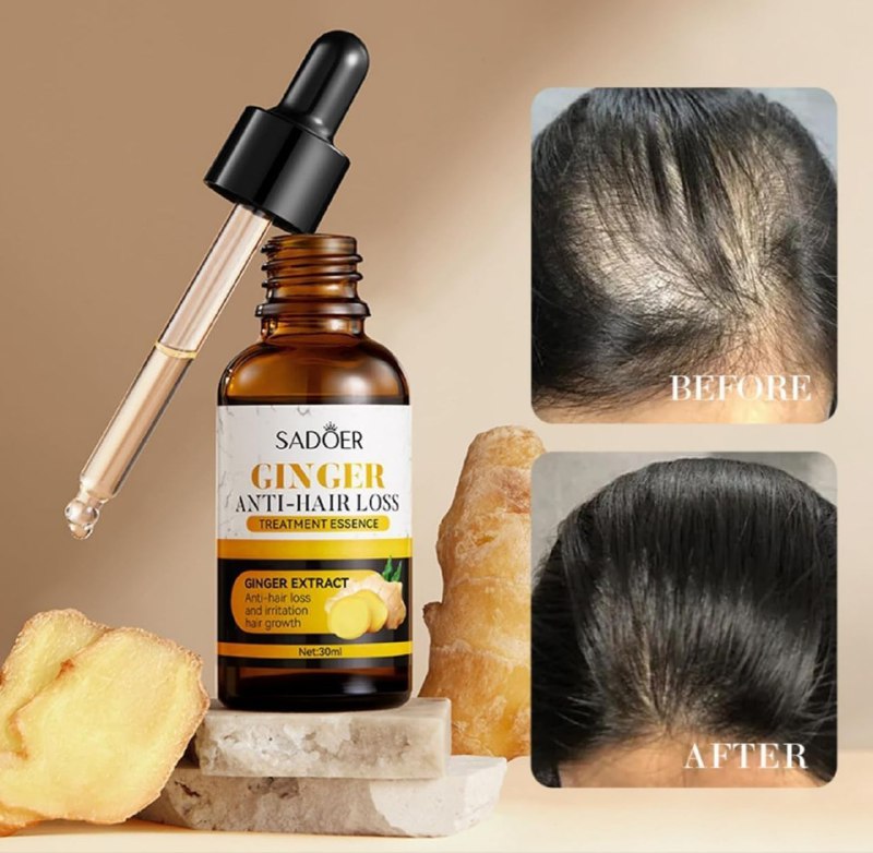 ACEITE PARA EL CABELLO ESENCIA DE JENGIBRE ANTICAIDA, PARA EL CRECIMIENTO DEL CABELLO, HIDRATANTE SADOER 30ML