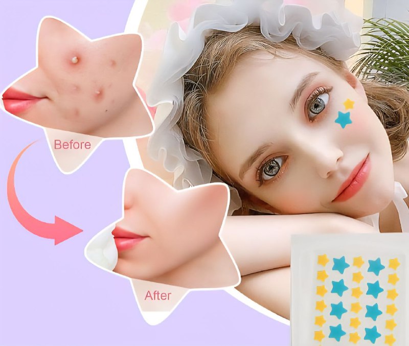 PARCHE PARA EL ACNE, FORMA REDONDO Y ESTRELLA, CUBRE LA PIEL CON ACNE Y MEJORA LA ESTETICA, AISLA LA CONTAMINACION, LIGERO, FINO Y TRANSPARENTE SADOER 36UND