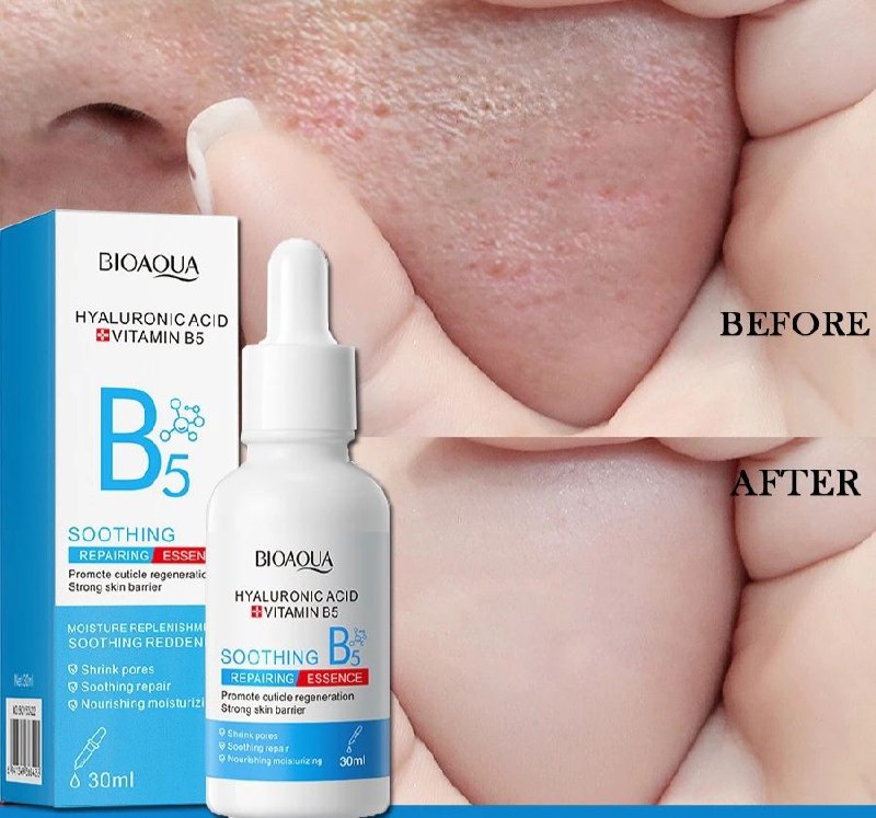 SUERO FACIAL ANTIENVEJECIMIENTO PARA LINEAS FINAS Y ARRUGAS BIOAUA 30ML